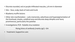 • Discrete rounded, red or purple infiltrated macules, 3-8 mm in diameter
• Site – face, scalp, back of neck and trunk
• Blueberry muffin lesions
• Other skin manifestation – cutis mamorata, seborhoea and hyperpigmentation of
the forehead, cheeks, umbilical area and discrete deep dimples over bony
prominences, particularly the patellae
• Investigations: PCR - Rubella virus isolation
Rising titres of antibody (mainly IgG) - EIA
• Treatment: Supportive care
 