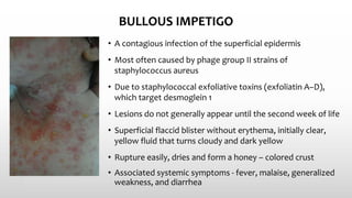 BULLOUS IMPETIGO
• A contagious infection of the superficial epidermis
• Most often caused by phage group II strains of
staphylococcus aureus
• Due to staphylococcal exfoliative toxins (exfoliatin A–D),
which target desmoglein 1
• Lesions do not generally appear until the second week of life
• Superficial flaccid blister without erythema, initially clear,
yellow fluid that turns cloudy and dark yellow
• Rupture easily, dries and form a honey – colored crust
• Associated systemic symptoms - fever, malaise, generalized
weakness, and diarrhea
 