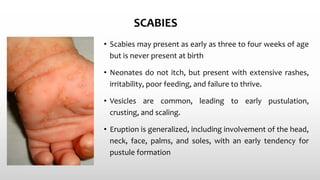 SCABIES
• Scabies may present as early as three to four weeks of age
but is never present at birth
• Neonates do not itch, but present with extensive rashes,
irritability, poor feeding, and failure to thrive.
• Vesicles are common, leading to early pustulation,
crusting, and scaling.
• Eruption is generalized, including involvement of the head,
neck, face, palms, and soles, with an early tendency for
pustule formation
 