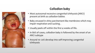 Collodion baby
• Most autosomal recessive congenital ichthyosis (ARCI)
present at birth as collodion babies
• Baby encased in shiny parchement-like membrane which may
impair respiration and sucking .
• Usually peels off within the first 4 weeks of life.
• In 80% of cases, collodion baby is followed by the onset of an
ARCI subtype
• Around 10–20% develop into self‐improving congenital
ichthyosis
 