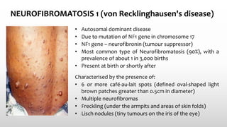 NEUROFIBROMATOSIS 1 (von Recklinghausen's disease)
• Autosomal dominant disease
• Due to mutation of NF1 gene in chromosome 17
• NF1 gene – neurofibronin (tumour suppressor)
• Most common type of Neurofibromatosis (90%), with a
prevalence of about 1 in 3,000 births
• Present at birth or shortly after
Characterised by the presence of:
• 6 or more café-au-lait spots (defined oval-shaped light
brown patches greater than 0.5cm in diameter)
• Multiple neurofibromas
• Freckling (under the armpits and areas of skin folds)
• Lisch nodules (tiny tumours on the iris of the eye)
 