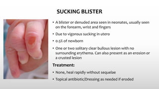 SUCKING BLISTER
• A blister or denuded area seen in neonates, usually seen
on the forearm, wrist and fingers
• Due to vigorous sucking in utero
• 0.5% of newborn
• One or two solitary clear bullous lesion with no
surrounding erythema. Can also present as an erosion or
a crusted lesion
Treatment:
• None, heal rapidly without sequelae
• Topical antibiotic/Dressing as needed if eroded
 