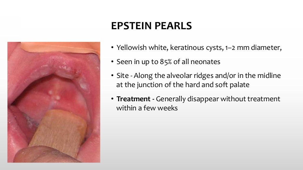 Common skin conditions in neonates