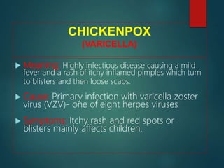 CHICKENPOX
(VARICELLA)
 Meaning: Highly infectious disease causing a mild
fever and a rash of itchy inflamed pimples which turn
to blisters and then loose scabs.
 Cause: Primary infection with varicella zoster
virus (VZV)- one of eight herpes viruses
 Symptoms: Itchy rash and red spots or
blisters mainly affects children.
 