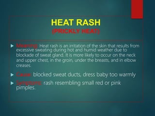 HEAT RASH
(PRICKLY HEAT)
 Meaning: Heat rash is an irritation of the skin that results from
excessive sweating during hot and humid weather due to
blockade of sweat gland. It is more likely to occur on the neck
and upper chest, in the groin, under the breasts, and in elbow
creases.
 Cause: blocked sweat ducts, dress baby too warmly
 Symptoms: rash resembling small red or pink
pimples.
 