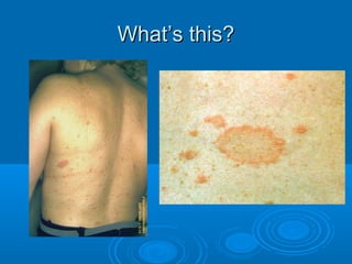 WWhhaatt’’ss tthhiiss?? 
 