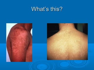 WWhhaatt’’ss tthhiiss?? 
 