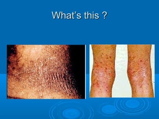 WWhhaatt’’ss tthhiiss ?? 
 