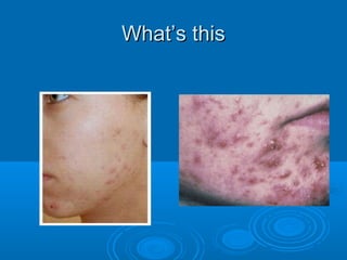 WWhhaatt’’ss tthhiiss 
 