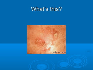 WWhhaatt’’ss tthhiiss?? 
 