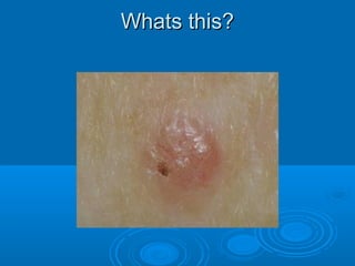 WWhhaattss tthhiiss?? 
 