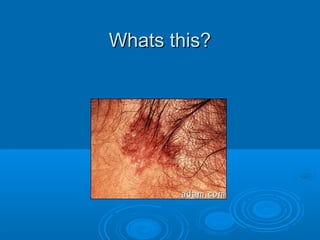 WWhhaattss tthhiiss?? 
 