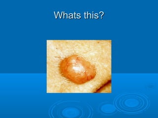 WWhhaattss tthhiiss?? 
 