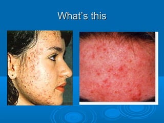 WWhhaatt’’ss tthhiiss 
 