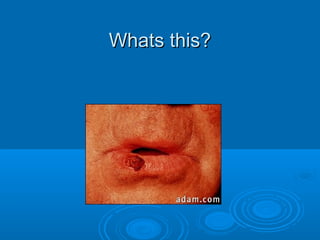 WWhhaattss tthhiiss?? 
 