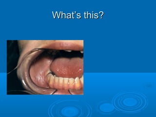 WWhhaatt’’ss tthhiiss?? 
 