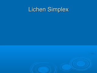 LLiicchheenn SSiimmpplleexx 
 