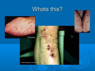 WWhhaattss tthhiiss?? 
 