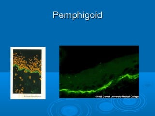 PPeemmpphhiiggooiidd 
 