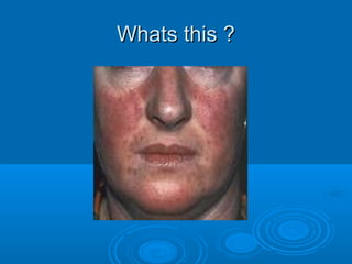 WWhhaattss tthhiiss ?? 
 