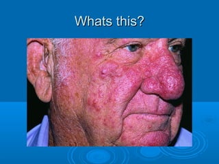 WWhhaattss tthhiiss?? 
 