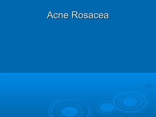 AAccnnee RRoossaacceeaa 
 