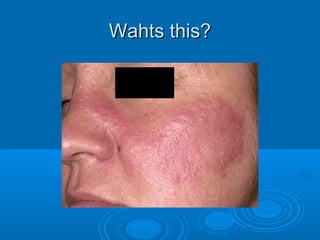 WWaahhttss tthhiiss?? 
 