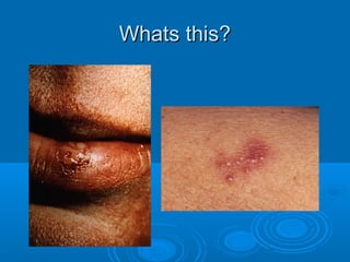 WWhhaattss tthhiiss?? 
 