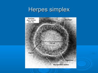 HHeerrppeess ssiimmpplleexx 
 