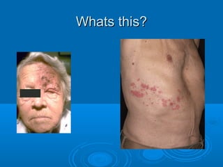 WWhhaattss tthhiiss?? 
 