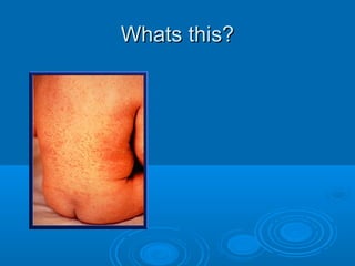 WWhhaattss tthhiiss?? 
 