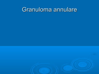 GGrraannuulloommaa aannnnuullaarree 
 