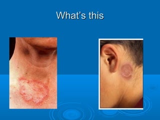 WWhhaatt’’ss tthhiiss 
 