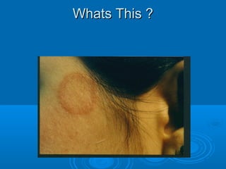 WWhhaattss TThhiiss ?? 
 