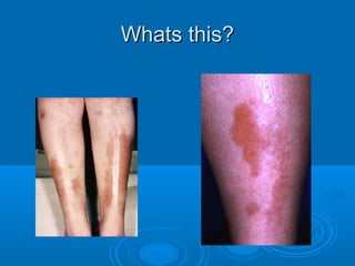 WWhhaattss tthhiiss?? 
 