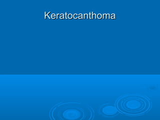 KKeerraattooccaanntthhoommaa 
 