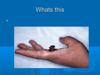 WWhhaattss tthhiiss 
 
 