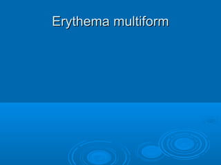 EErryytthheemmaa mmuullttiiffoorrmm 
