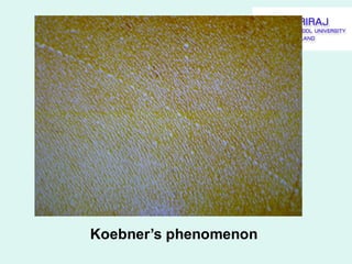 Common skin diseases | PDF