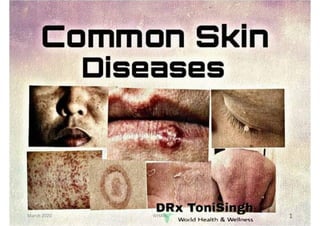 Most Common skin diseases drx_tonisingh