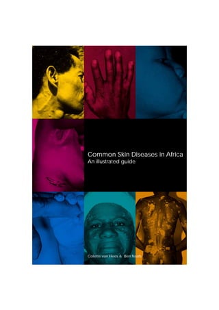 Common Skin Diseases in Africa
An illustrated guide
Colette van Hees & Ben Naafs
 