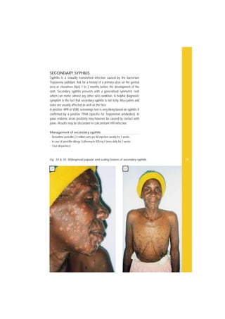 Treponema Rash Common Skin Diseases in Africa Illustrated Guide 2001.pdf