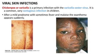 Skin Infection Color COMMON SKIN INFECTIONS IN CHILDREN.pptx