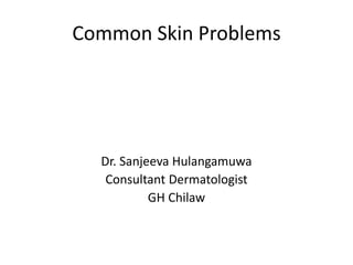 Common Skin Problems
Dr. Sanjeeva Hulangamuwa
Consultant Dermatologist
GH Chilaw
 