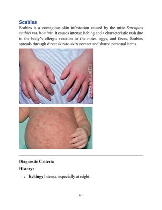 Scabies Body Distribution Common skin problems of kids by Dr Habibur Rahim V 1.1.pdf