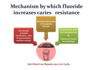 Mechanism by which fluoride
increases caries resistance
Increased
enamel
resistance , rate
of maturation,
surface energy
Remineralization
of incipient
lesions
Interference with
microorganisms
&
Improved tooth
morphology
Int J Dent Case Reports 2011; 1(2): 73-84
 
