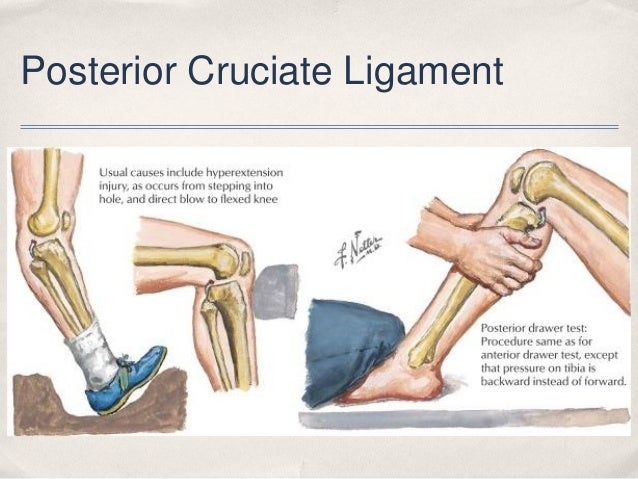 Common Sports Injuries 2560