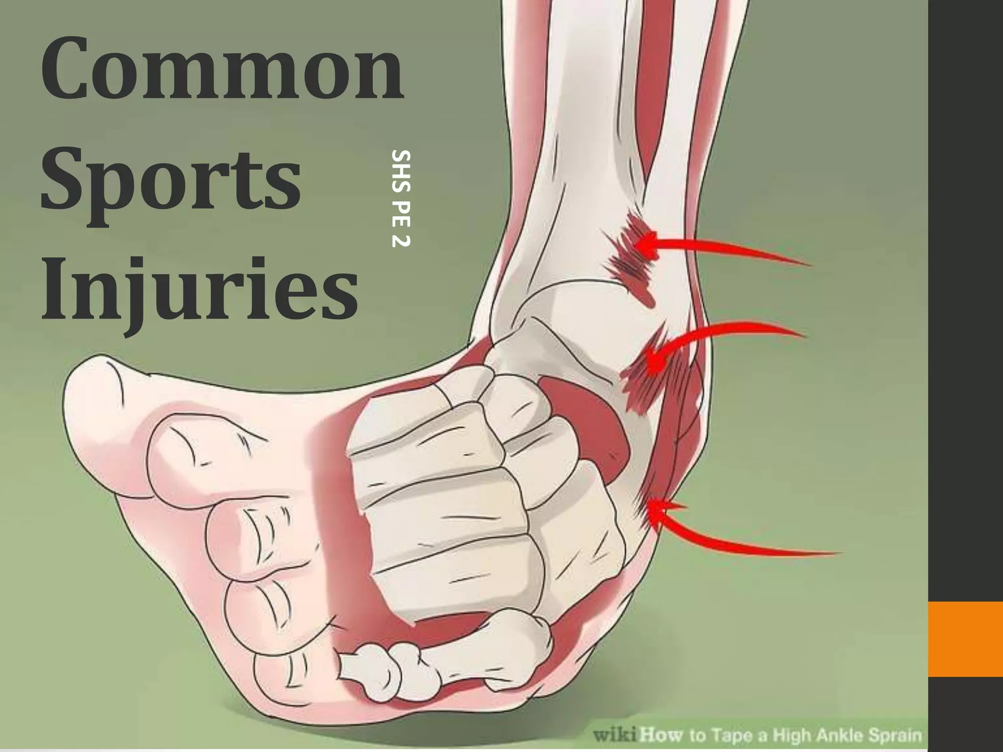Common sports injuries | PPTX