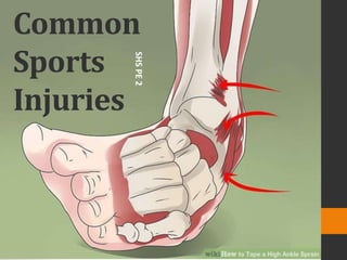 Common
Sports
Injuries
SHSPE2
 