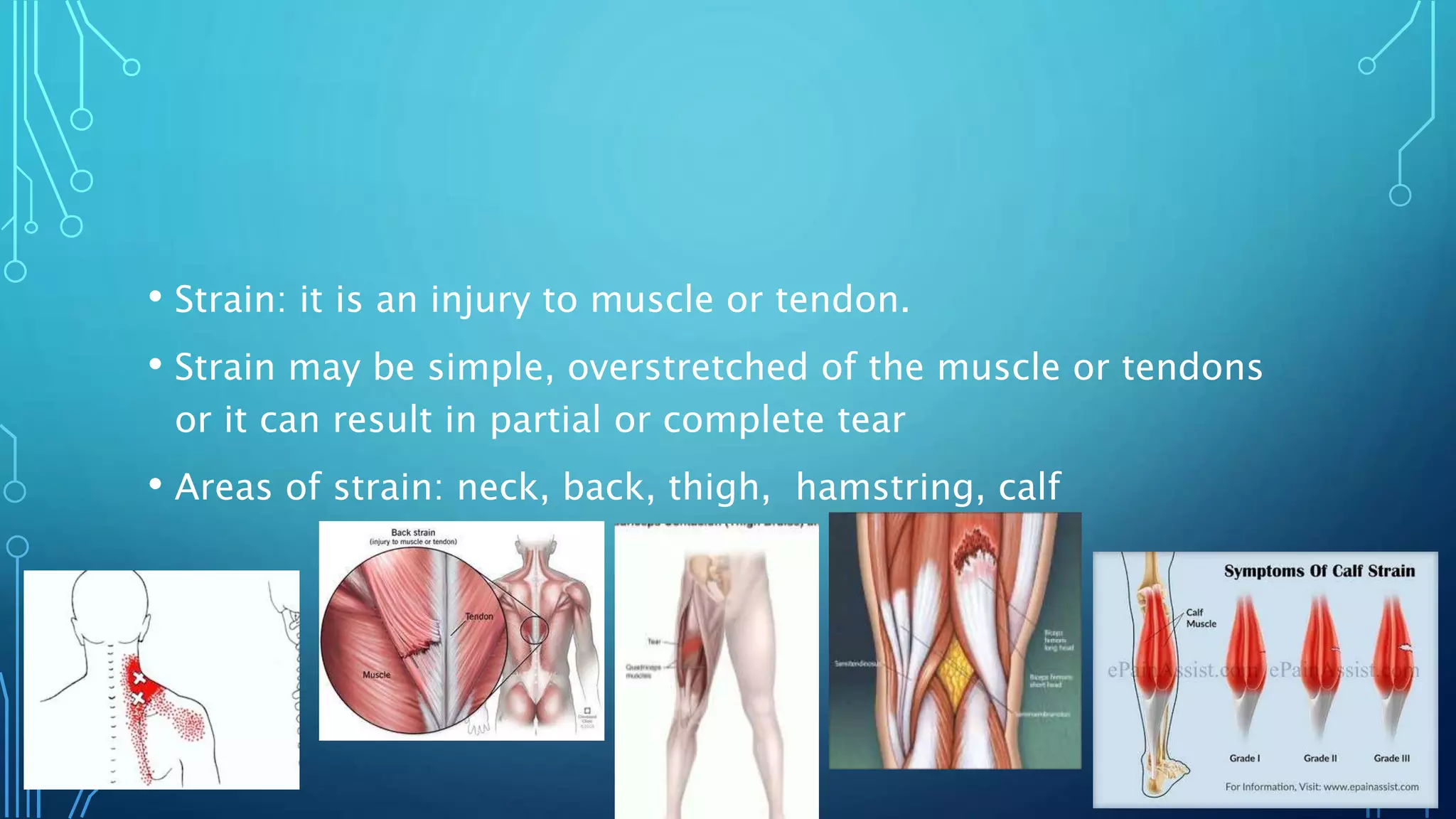Example Of Strain Injuries Common sports injuries and treatment | PPTX
